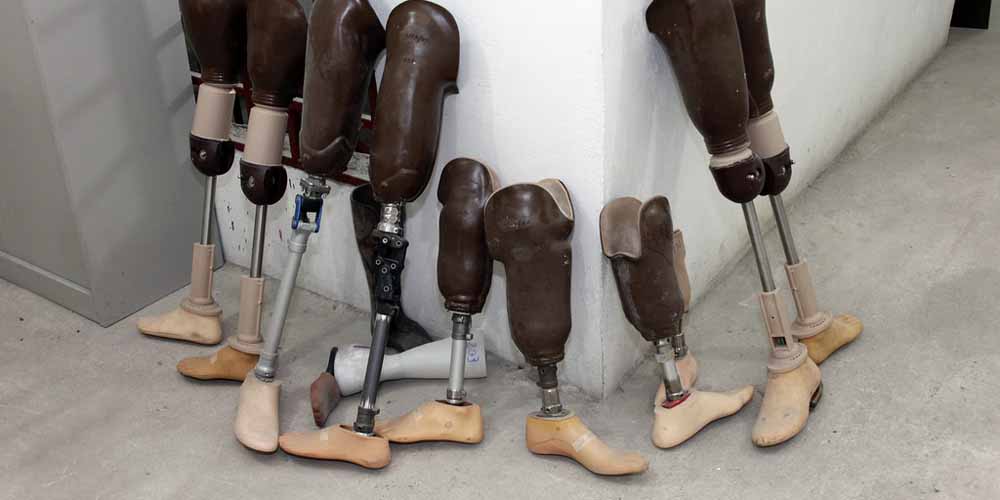 Bet On Athletes With Prosthetic Limbs – Awe-Inspiring Performances