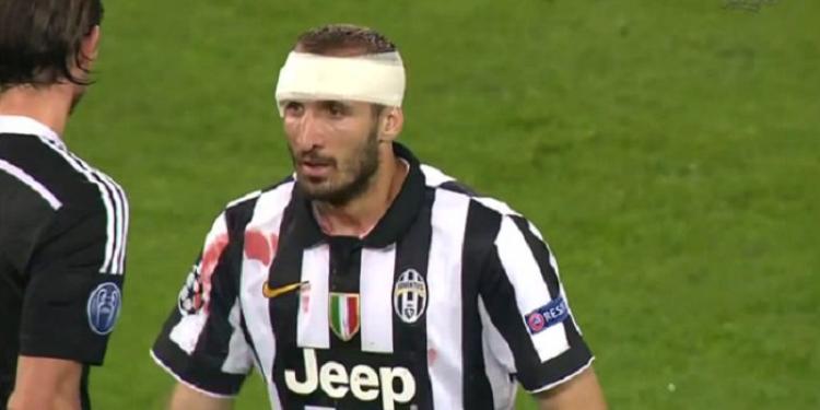Chiellini Injured, Can’t Play in the Champions League Final