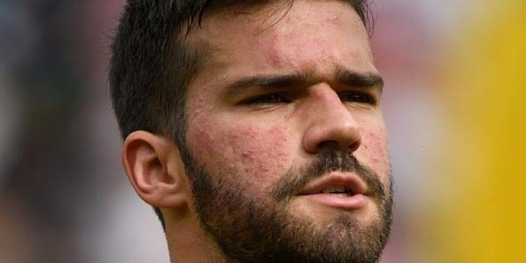 Should You Bet on Alisson Becker to Transfer to a New Team?